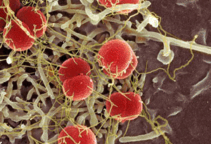 Image: Colored scanning electron micrograph (SEM) of Neisseria meningitidis bacteria (red) on human epithelium (Photo courtesy of SPL).